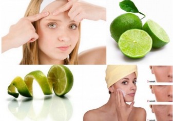 Cách trị mụn bọc tại nhà bằng 4 nguyên liệu tự nhiên